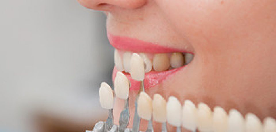 Going For Cosmetic Dentistry?